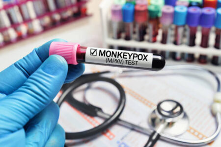 Mpox virus outbreak
